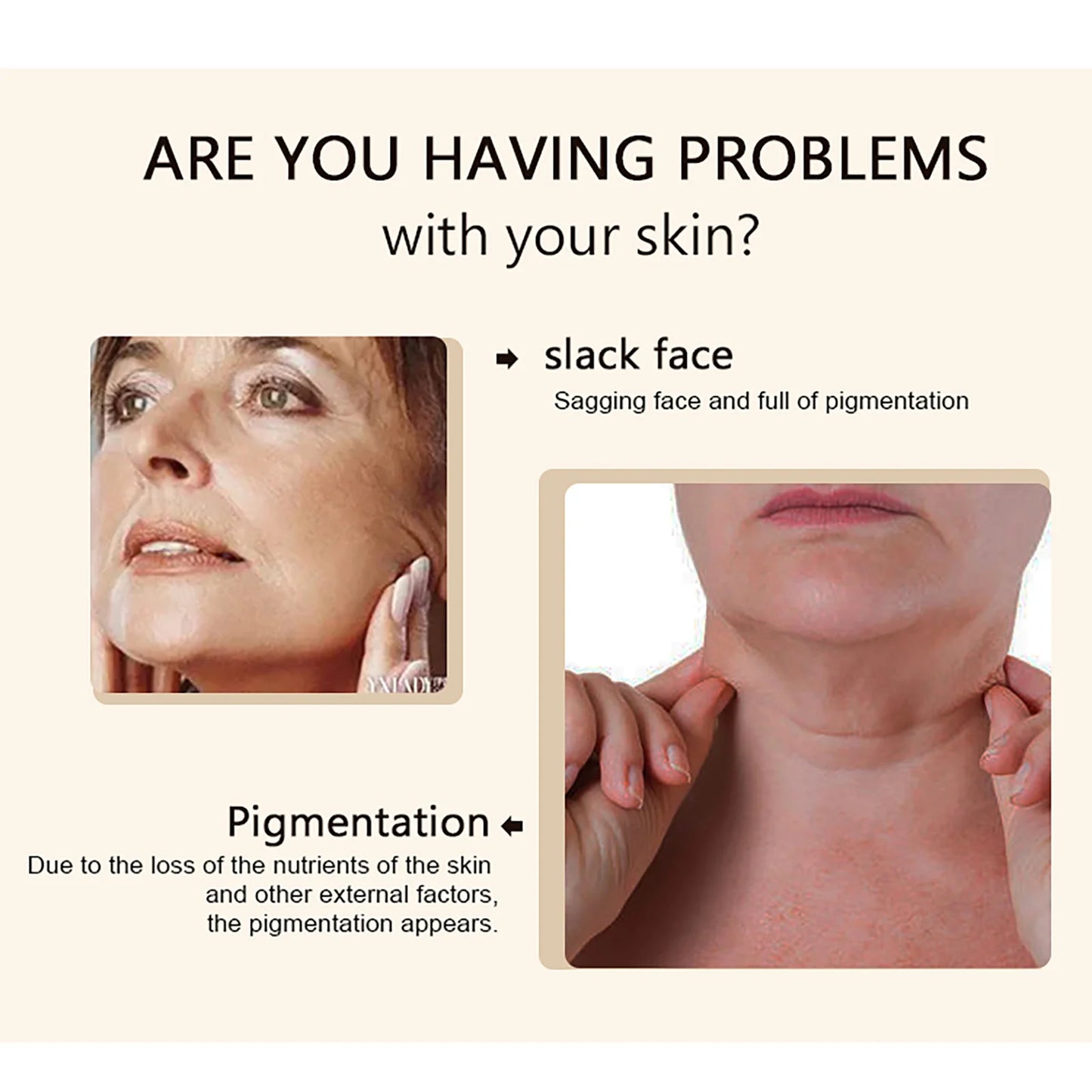 KYLIEFIT Collagen Whitening Cream For Skin Brightening And Hydration